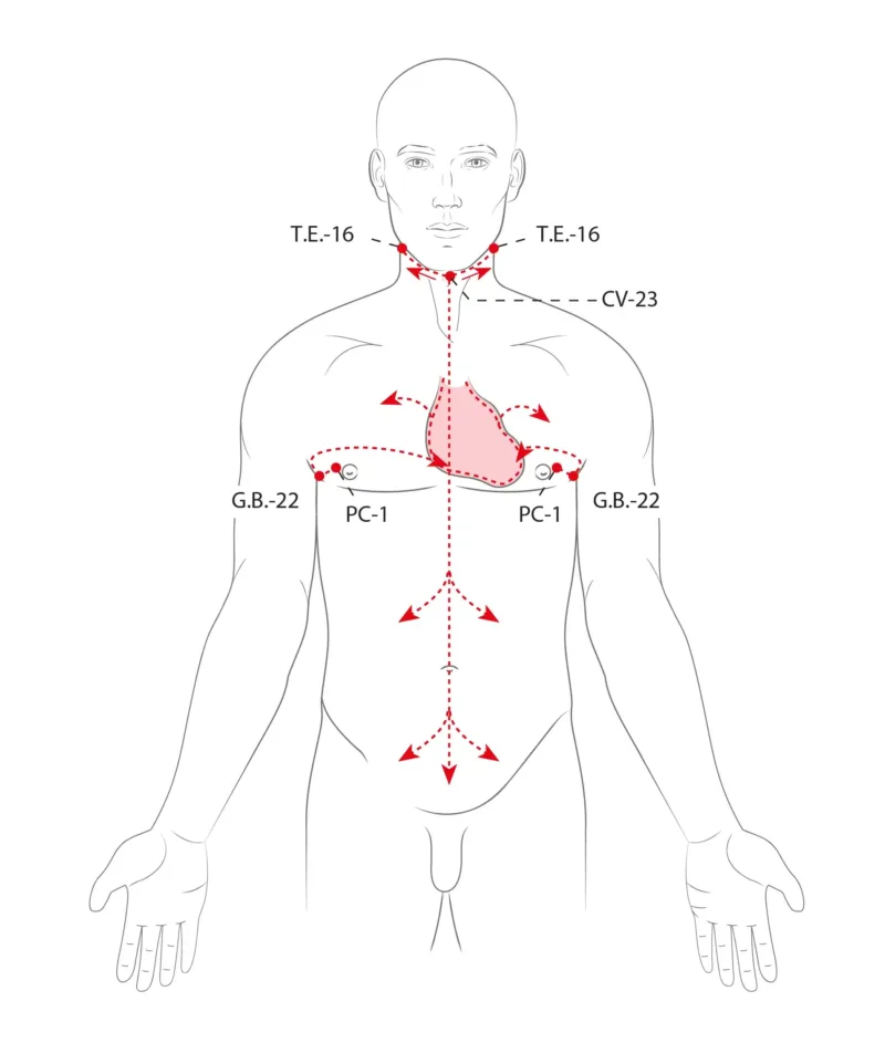 Divergentní dráhy podle tradiční čínské medicíny