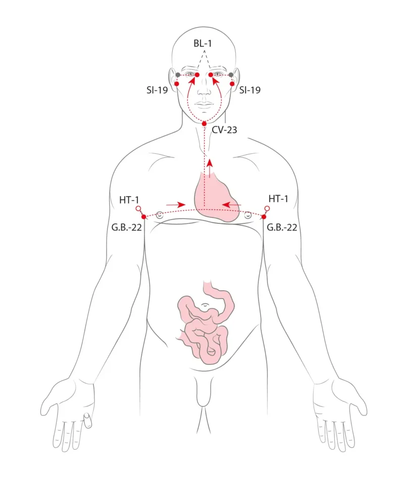 Divergentní dráhy podle tradiční čínské medicíny
